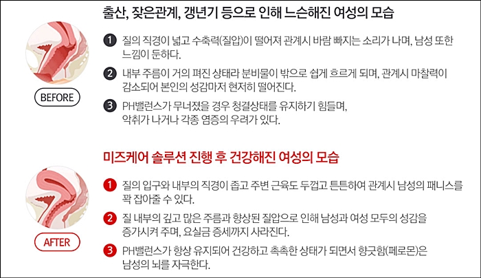 미즈케어솔루션 가격